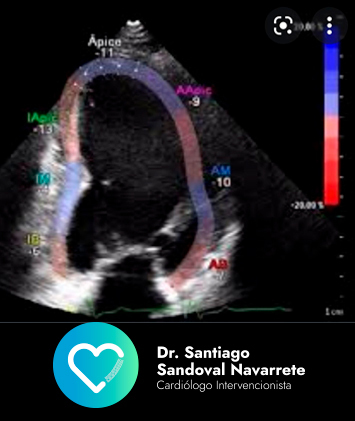 ecocardiograma ultrasonografía del corazón vs