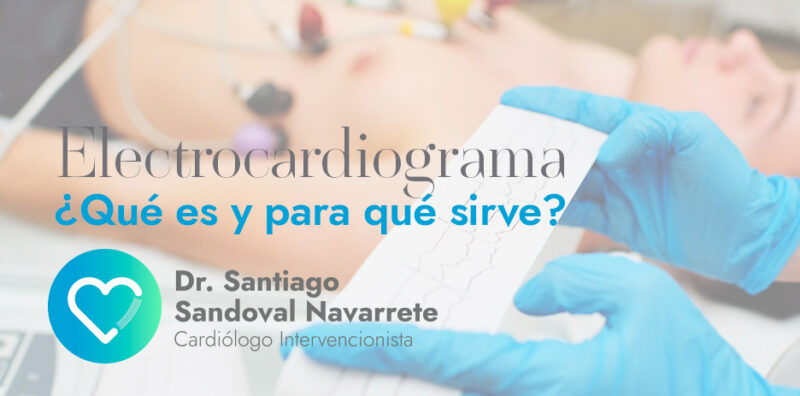 Tipos De Ecocardiograma Santiago Sandoval Cardi Logo