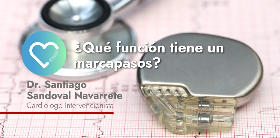 Que función tiene un marcapasos